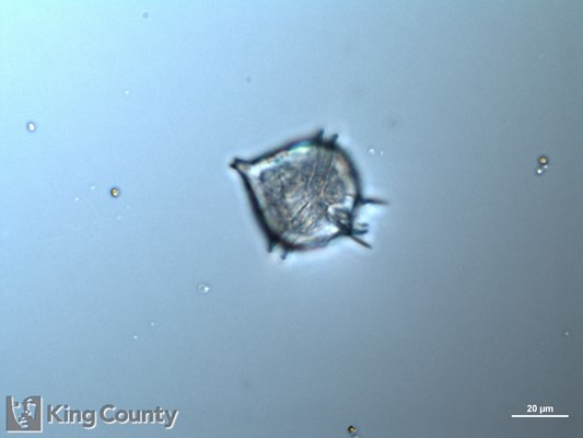 Photo of Protoperidinium pellucidum/Protoperidinium steinii